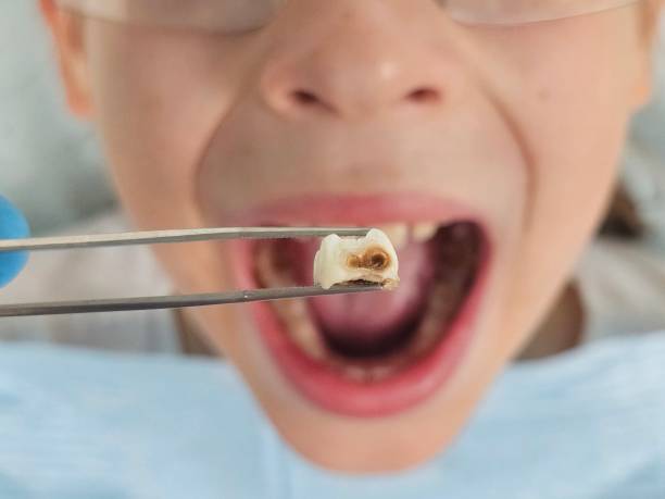 Best Pediatric Emergency Dentist in Antioch, IL